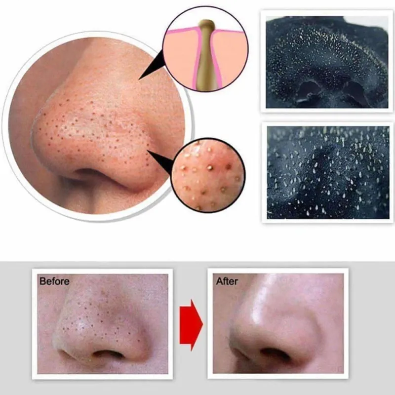 Blackhead Deep Cleansing Facial Mask